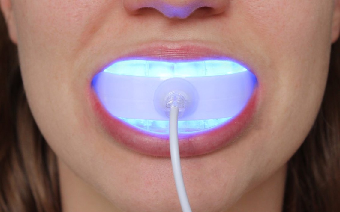 why-does-blue-light-whiten-teeth